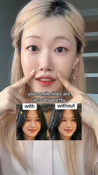 Why your smile lines are beautiful✨💕 smile big ...#shorts