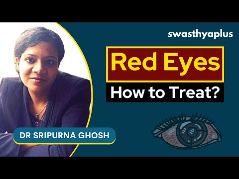 Red Eyes- What to do? | Dr Sripurna Ghosh