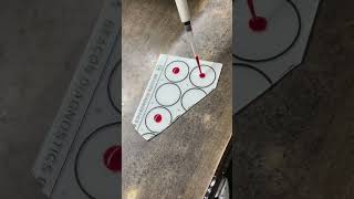 Blood group AB,A,B,O testing#Practical std#viral #srhu