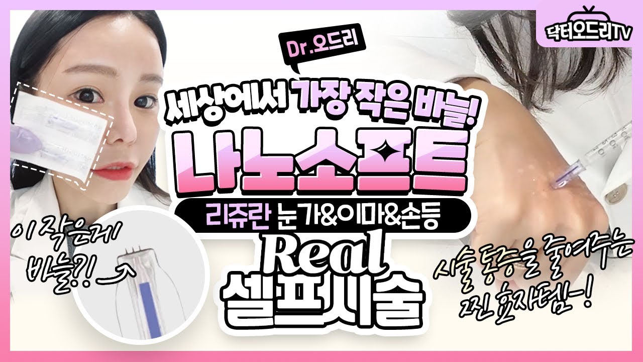 [닥터오드리 셀프시술] 리쥬란힐러 나노소프트로 눈가, 눈밑, 이마, 손등에 시술해봤어요!