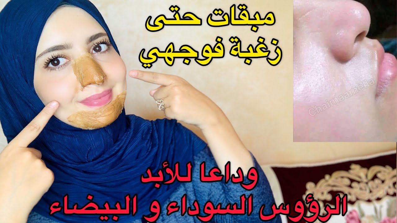 ‎أسهل طريقه لإزله الرؤوس السودا والبيضاء في البيت/وإزله الدهون من الوجه بمكونات طبيعيه مضمونه ومجربه
