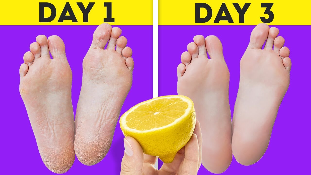 Best Hacks For Your Feet And Shoes