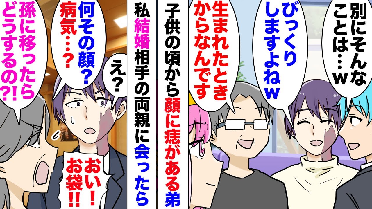 【漫画】生まれた時から顔に痣がある弟。義母「何その顔！孫にもそんな痣があったらどうしよう！」結婚の挨拶で相手の両親に家族を会わせたら、義母がそんなことを言って来た。結婚後も義母とは接触を控えたのだが…