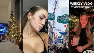 SPEND THE WEEK WITH ME | skin updates, running a half marathon, Gymshark events and festive fun