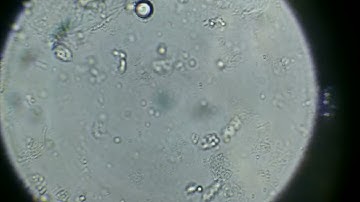 Bacteria Test with the Mil-kin Digital Microscope.