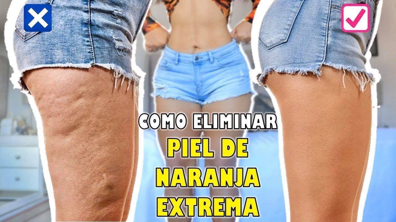 MI TÉCNICA PARA ELIMINAR CELULITIS EXTREMA a prueba de todo YouTube MI TÉCNICA PARA ELIMINAR CELULITIS EXTREMA a prueba de todo YouTube