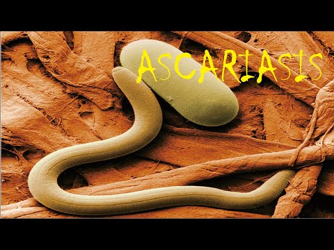 Video: Ascariasis - Gejala, Kaedah Rawatan