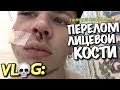 VLOG: МНЕ СЛОМАЛИ ЛИЦЕВУЮ КОСТЬ / Андрей Мартыненко