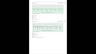 Relias Dysrhythmia Basic Test 35 Questions and Answers 2025 Basic A Dysrhythmia