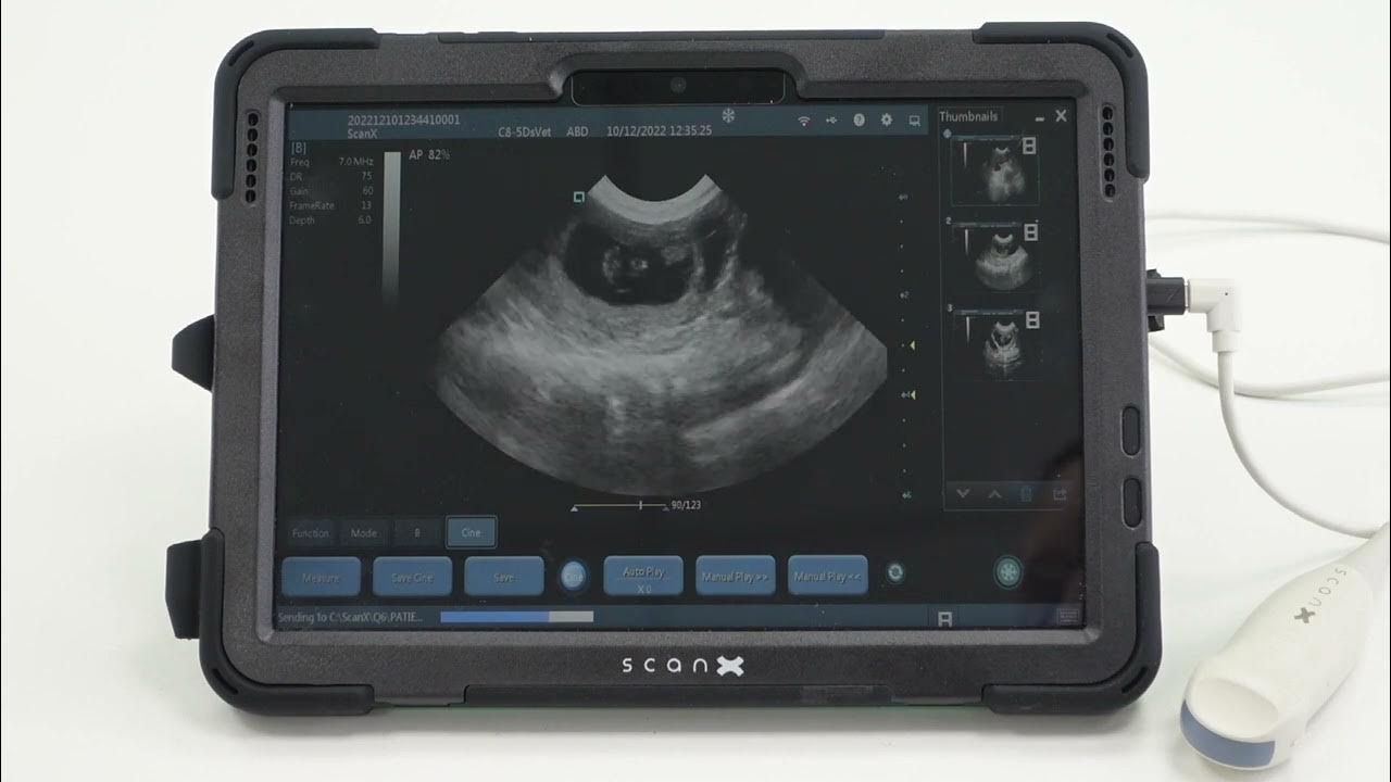 How to find and export images on your ScanX ultrasound machine YouTube
