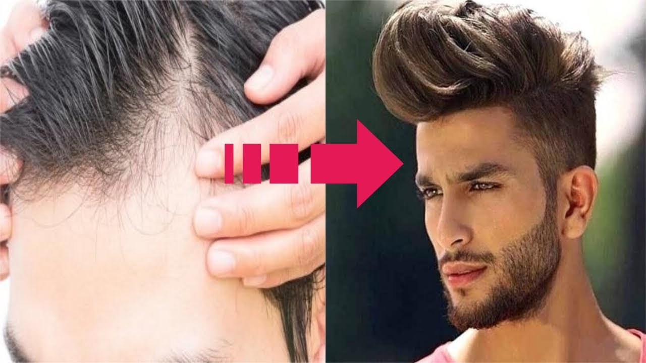 How To Get Thicker, Fuller & Healthy Hair For Men - Hair Loss Prevention  Tips | Men's Hair care Tips - YouTube