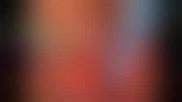 Pelvic lymphadenectomy (LAD) during robot-assisted radical prostatectomy or cystectomy