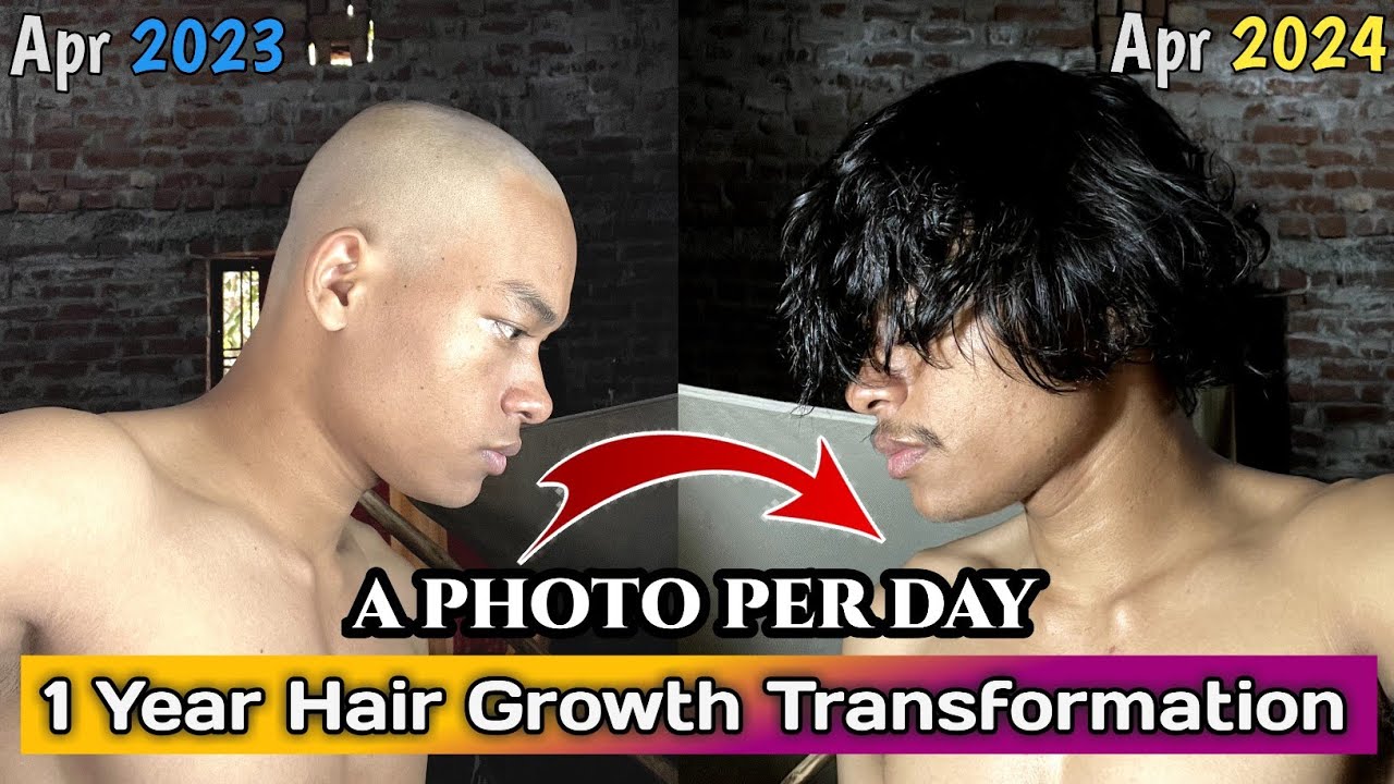 How Many Inches Can Hair Grow In A Year