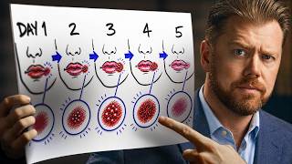 The 5 Stages of a Cold Sore (Day by Day)