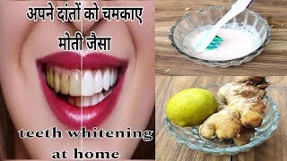 Teeth whitening at home||दांतों को सफेद करने का सबसे आसान तरीका 