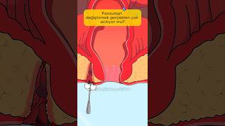 Pansuman Değiştirmek Gerçekten Çok Acıtıyor Mu?