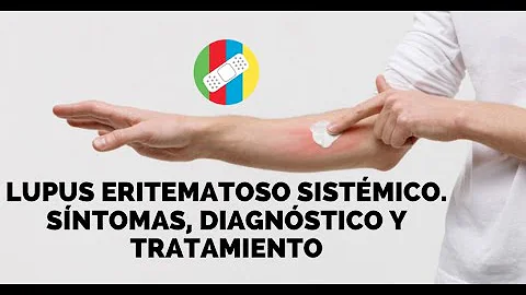 ¿Qué puede imitar los síntomas del lupus?