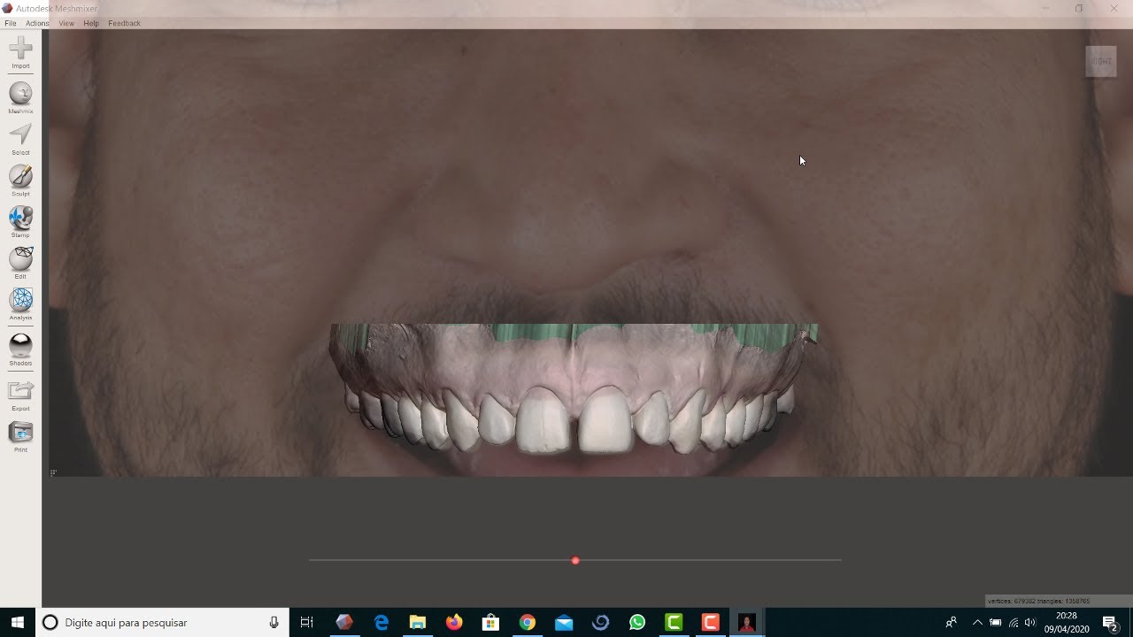 Meshmixer alinhamento da arcada em arquivo stl com a foto de sorriso frontal do paciente