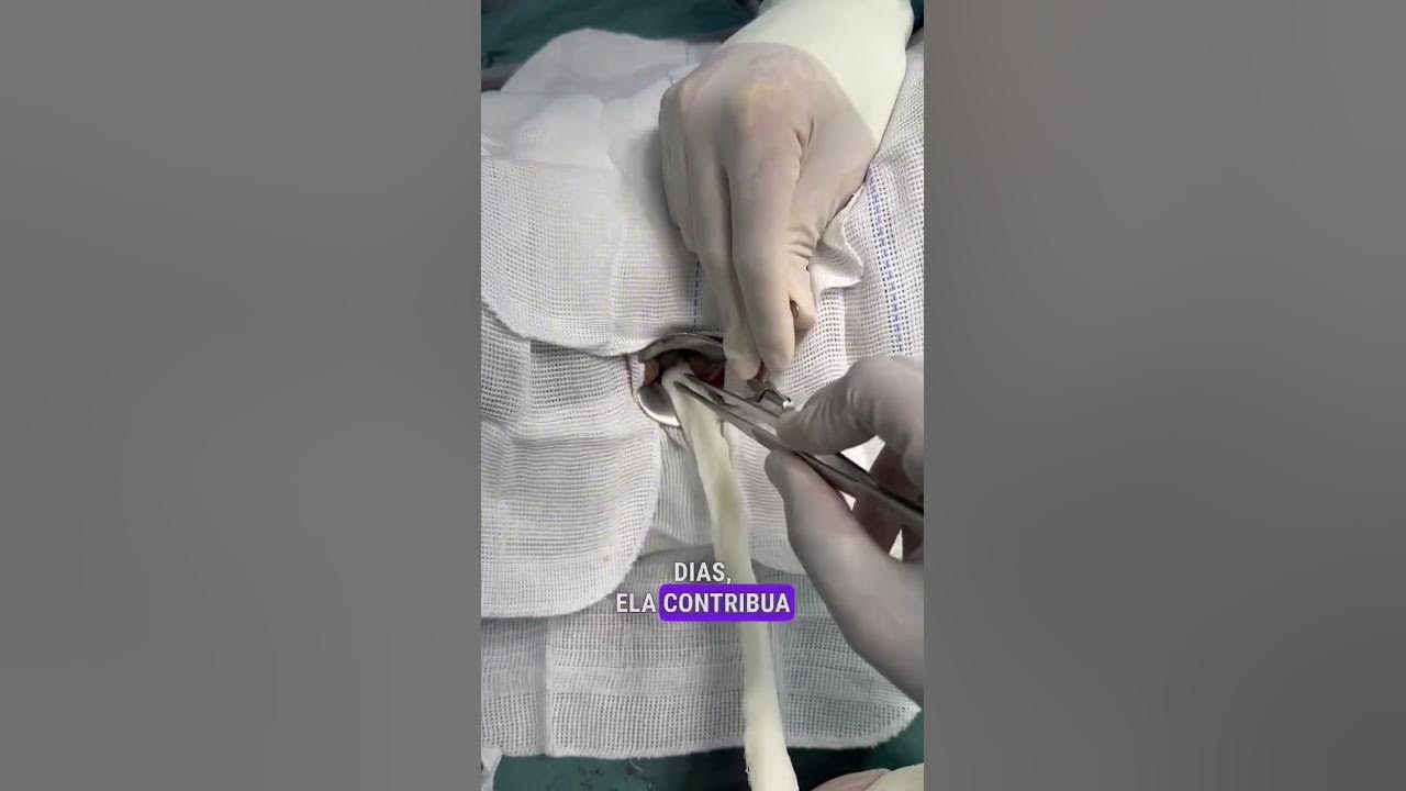 Sanatoriylarda yashirin kamera porno Polshada jinsiy aloqa video