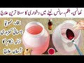 Catarrh cough labored breathing cold flu sneezing and fever treatment in chickens  dr arshad
