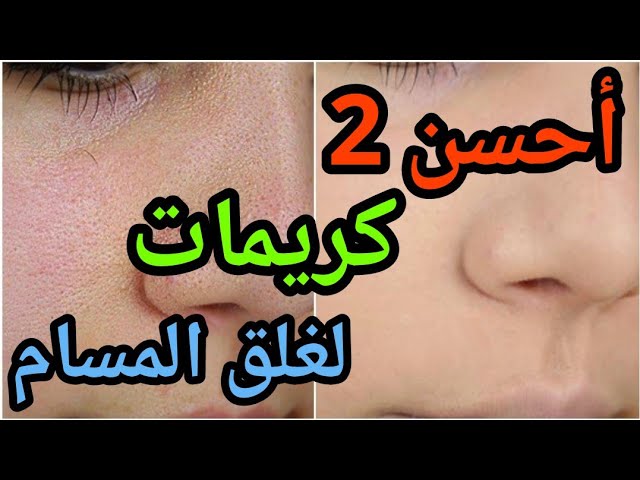 أفضل نوعين من الكريمات لغلق المسام نهائيا وفي فترة قصيرة