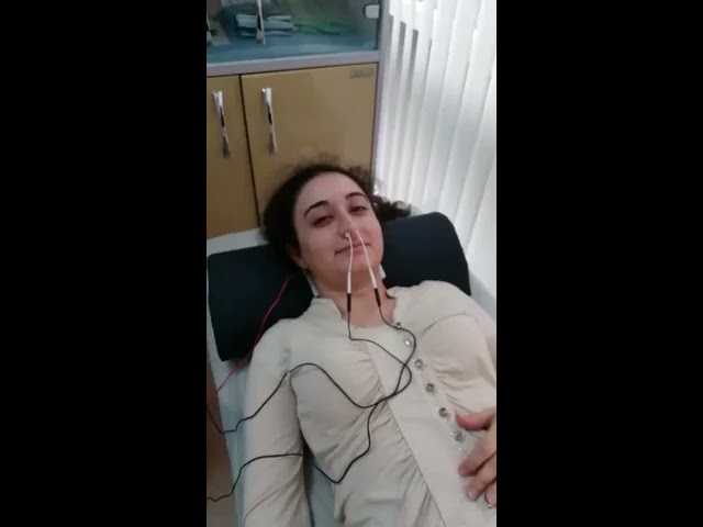 Эндоназальный электофорез с эмоксипином