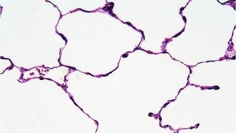 Respiratory epithelium - Mucosa, goblet cells and basement membrane