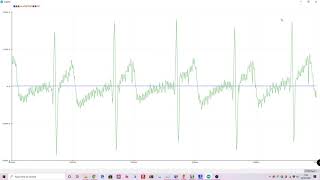 RAW ECG via UART Stream - Max30003 AFE nRF52832 MCU BLE Wearble Health Monitor Project