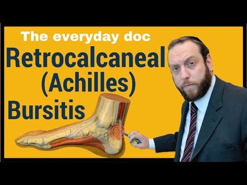 Retrocalcaneal bursitis or Achilles Bursitis