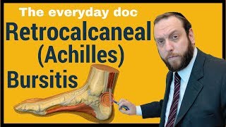 Retrocalcaneal bursitis or Achilles Bursitis