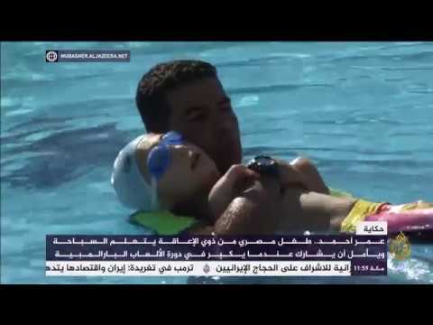 عمر أحمد الطفل المصري المعجزة