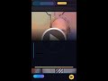 Science &amp; Tech News - Skin-Like Computing Patch Maps Deadly Heart R #Shorts