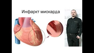 видео: Инфаркт миокарда – проявление и лечение. картинка: Инфаркт миокарда – проявление и лечение.
