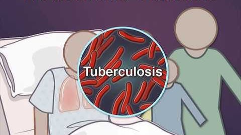 Contact Investigation for Tuberculosis
