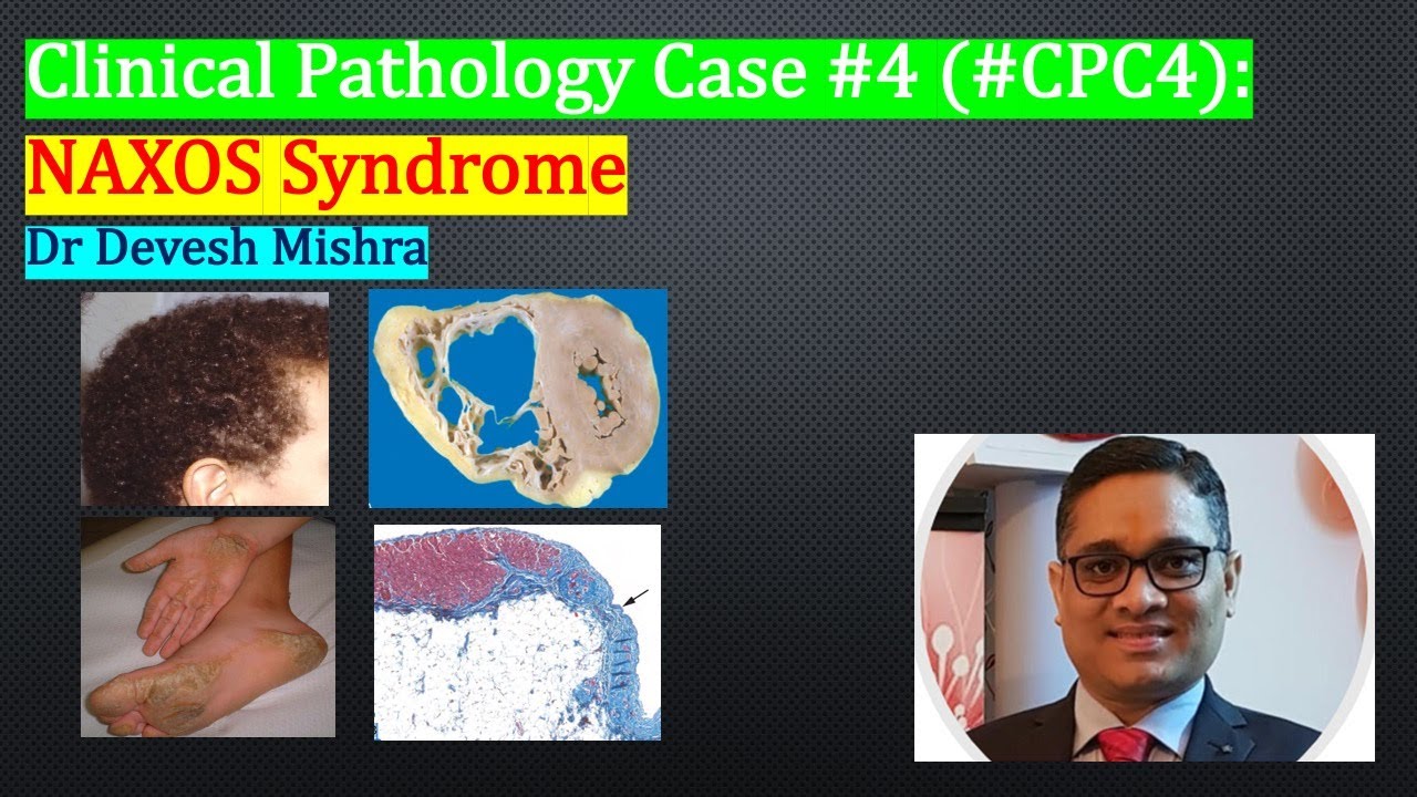 Clinical Pathology Case #4 (