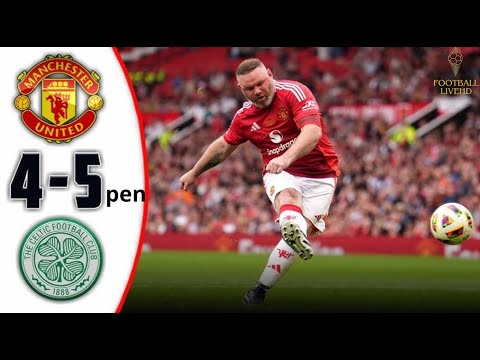 asiagol x geraitoto - Manchester United Legends vs Celtic Legends  All Goals & Highlights -2024