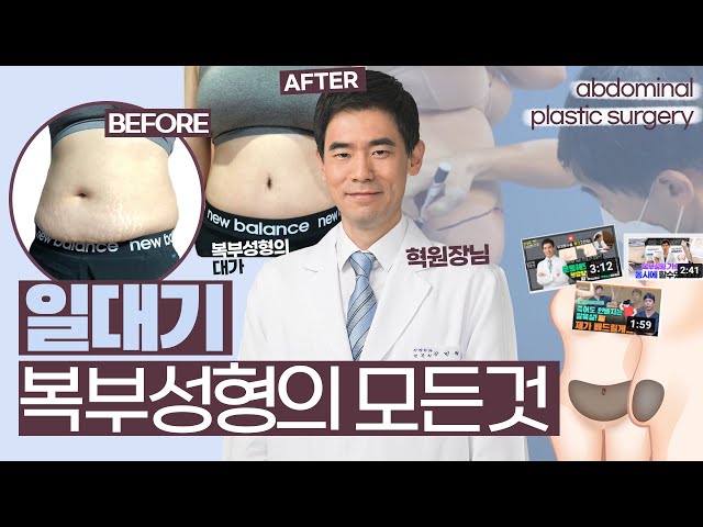 복부성형의 모든것 | 복부성형 전 확인해봐야하는 꿀팁과 주의사항!! | 우리뷰티TV