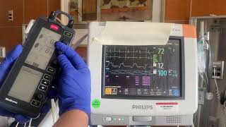 Temporary Pacemaker Threshold Testing