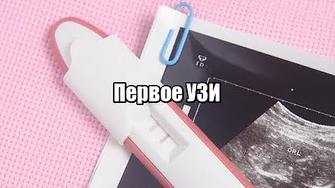 Положительный тест на беременность и первое УЗИ