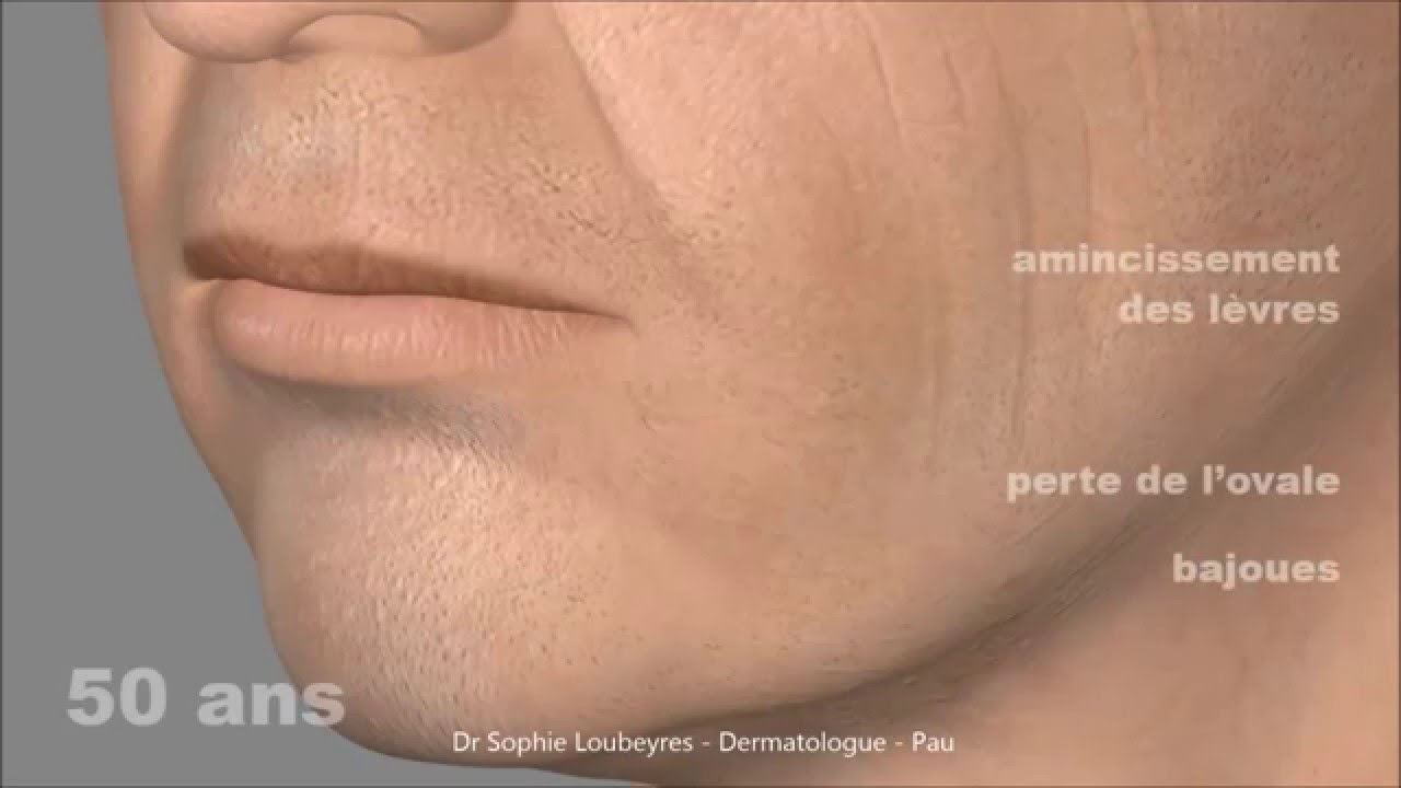 Vieillissement du tiers inférieur visage homme. Dermatologue Pau