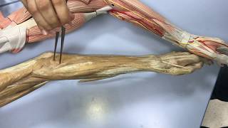 Anatomy of the Forearm 1.3 - Explanation on a plastinated model.