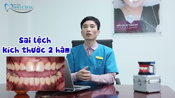 Cắt Kẽ Trong Niềng Răng | Bí Mật Niềng Răng Không Nhổ Răng
