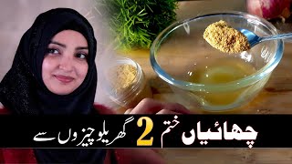 Remove "PIGMENTATION" (چھائیاں) with Onion Clear Your Face 100% Naturally Urdu Hindi screenshot 5