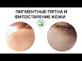 ПИГМЕНТНЫЕ ПЯТНА И ФИТОСТАРЕНИЕ КОЖИ