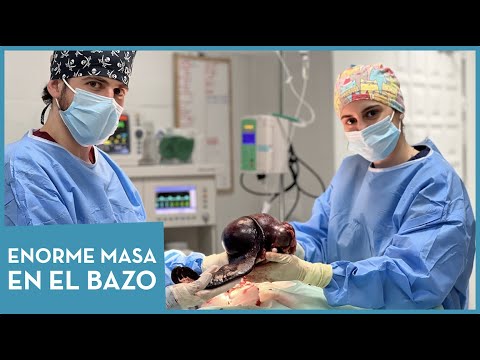 Video: Hemangiosarcoma: ¿Tumor canceroso en el bazo o tumor benigno?