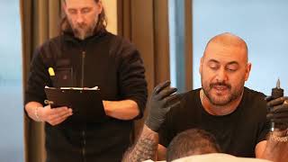 Scalp pigmentering