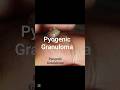 #pyogenic granuloma #surgery