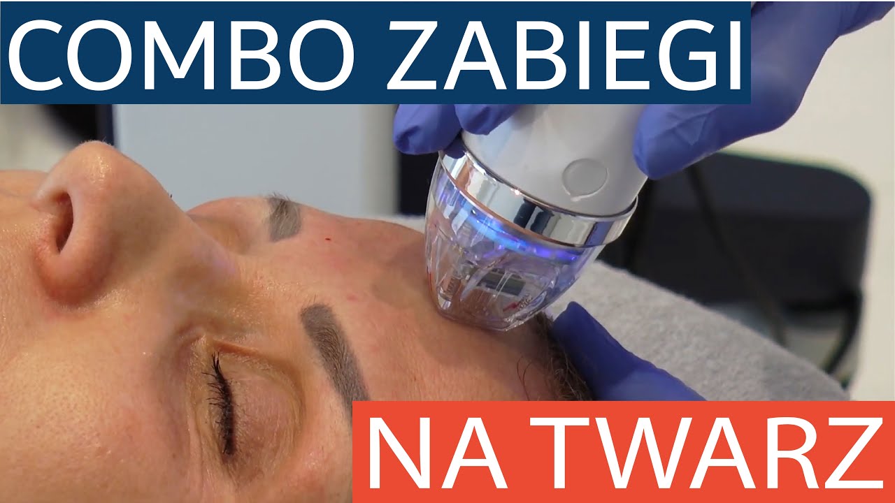 Combo zabiegi na twarz - radiofrekwencja mikroigłowa Secret RF i peeling laserowy Fraxis