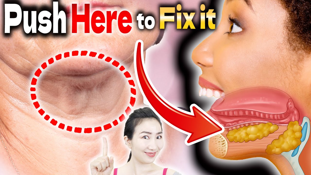 Push Sublingual Gland With Tongue To Drain Lymph And Tighten Under Jaw Push Sublingual Gland With Tongue To Drain Lymph And Tighten Under Jaw
