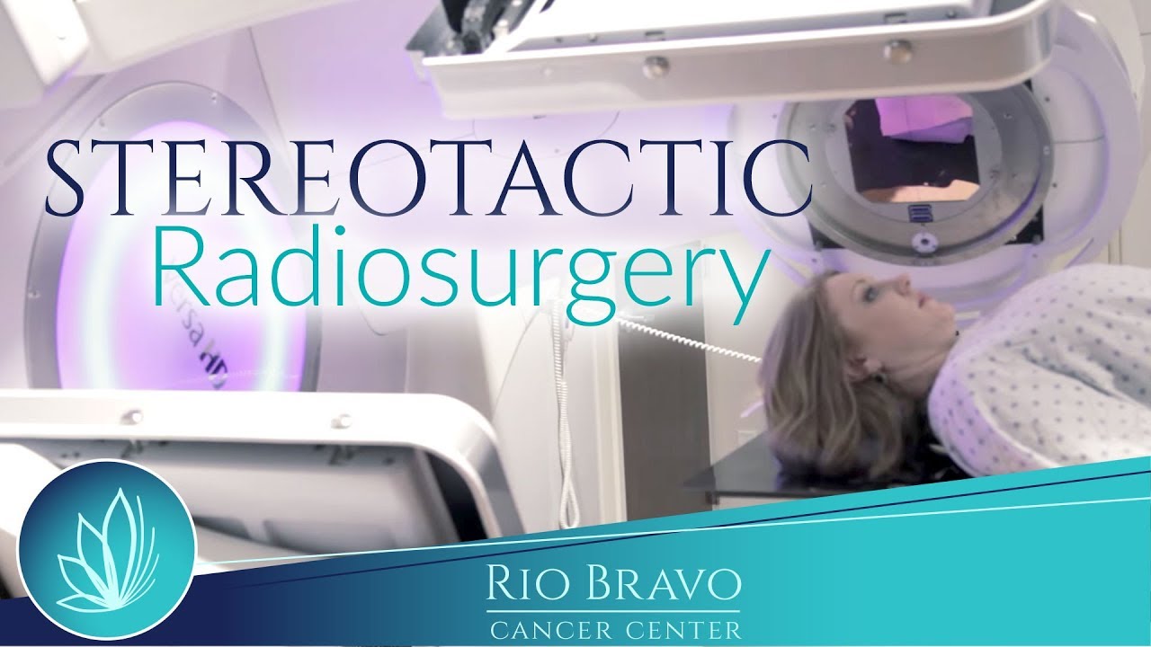 Stereotactic Radiosurgery Rio Bravo Cancer Center YouTube